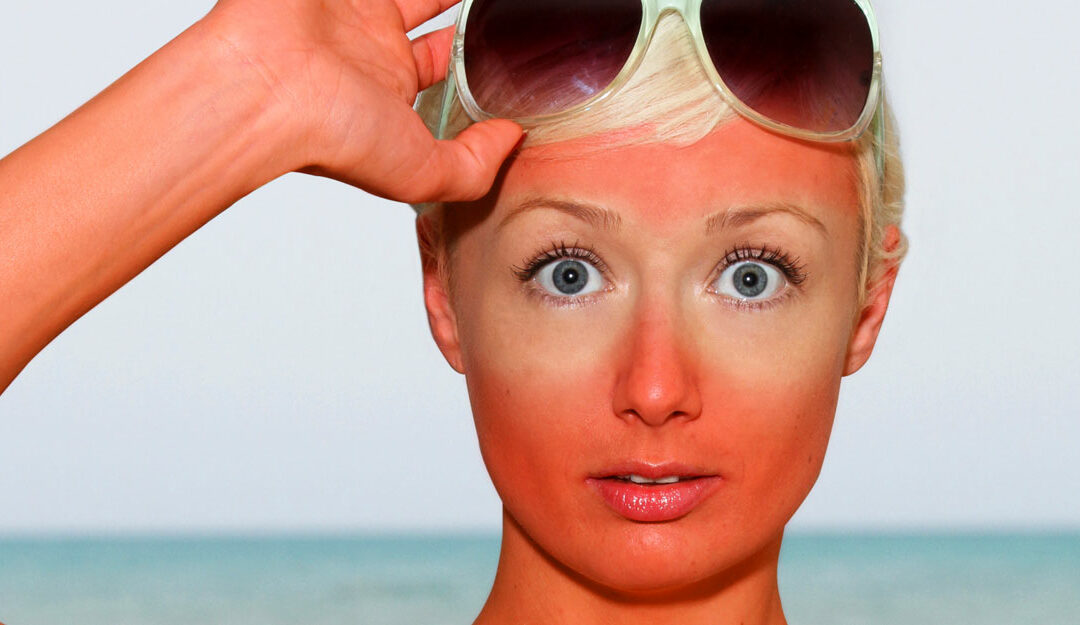 Fun in the Sun: Healthy Tips for National UV Safety Month