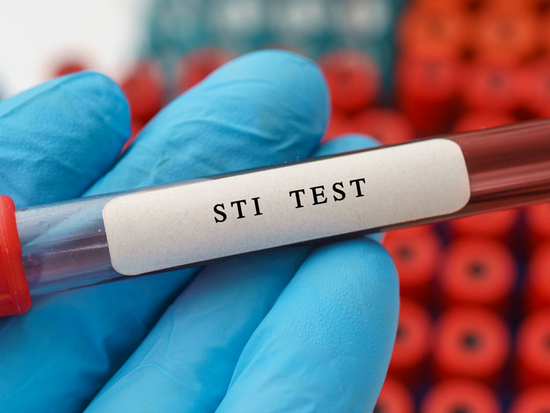 What’s the Importance of STI Testing and Who Needs One?